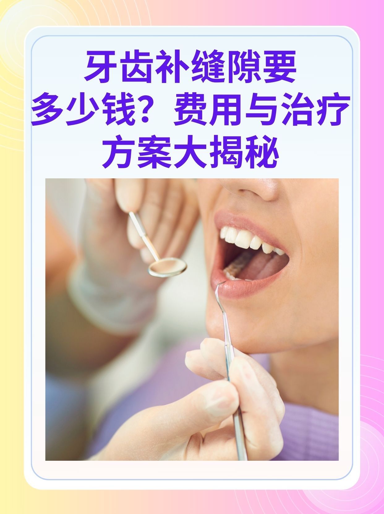 郑州补牙医保可以报销吗(补牙医保可以报销吗 哪些可以报销呢)